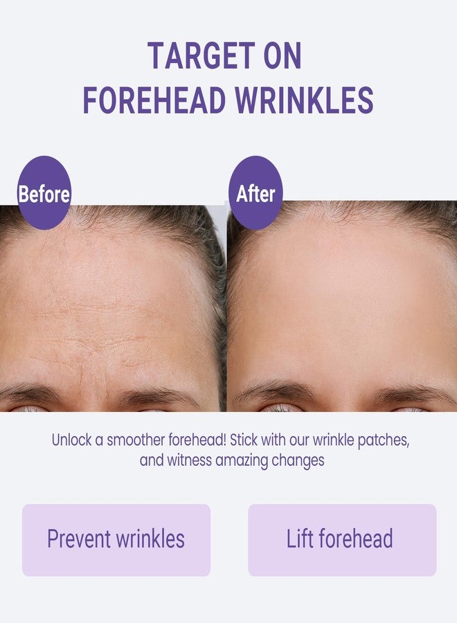 Sfuchin Forehead Wrinkle Patches, Sufchin 20 Pcs Face Lift Tape for Wrinkles Overnight Sweatproof & Hypoallergenic, Anti Wrinkle and Beauty Faical Skincare, Visible Lift & Deep Crease Care for Sensitive Skin - Image 2